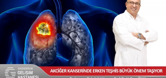 Akciğer Kanserinde Erken Teşhis Büyük Önem Taşıyor