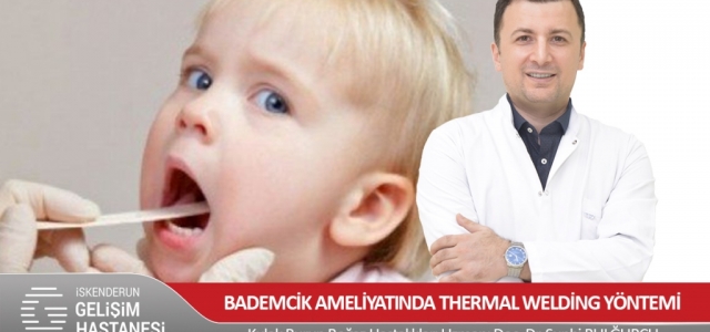 Bademcik Ameliyatında Thermal Welding Yöntemi