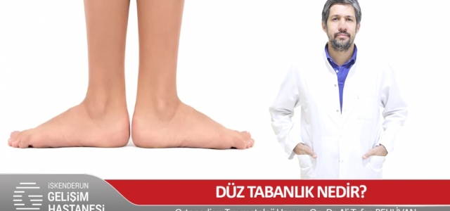 Düz Tabanlık Nedir?