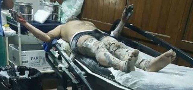 Elektrik Trafosunda Patlama: 2 İşçi Yaralı!