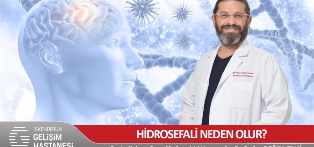 Hidrosefali Neden Olur?