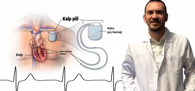 Kalp Pilleri Ani Ölümleri Engelliyor