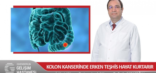 Kolon Kanserinde Erken Teşhis Hayat Kurtarır