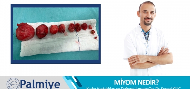 Miyom Nedir?