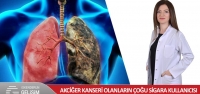 Akciğer Kanseri Olanların Çoğu Sigara Kullanıcısı
