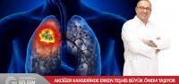 Akciğer Kanserinde Erken Teşhis Büyük Önem Taşıyor