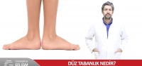 Düz Tabanlık Nedir?