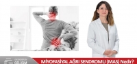 Miyofasiyal Ağrı Sendromu (Mas) Nedir?