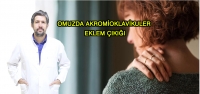 Omuzda Akromioklavikuler Eklem Çıkığı Nedir?