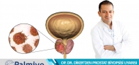 Op. Dr. Yusuf Diker'den Prostat Biyopsisi Uyarısı