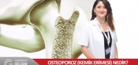 Osteoporoz (Kemik Erimesi) Nedir?