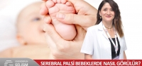 Serebral Palsi Bebeklerde Nasıl Görülür?